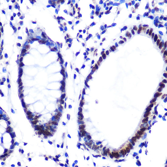 Hydroxyl-Histone H2A-Y39 Rabbit mAb