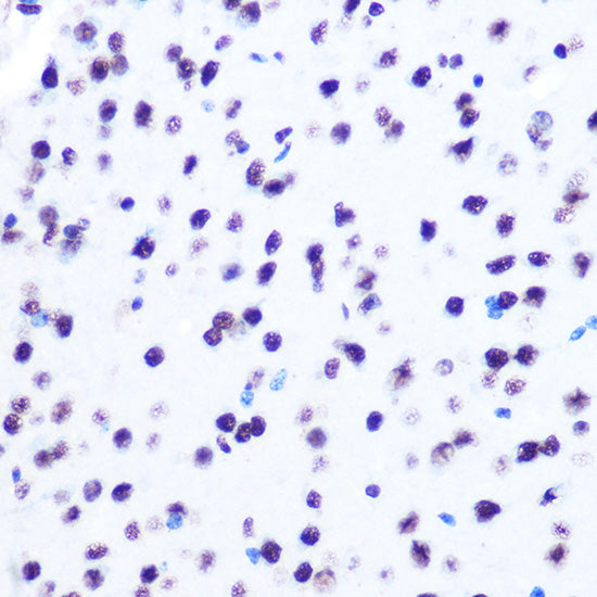Hydroxyl-Histone H2A-Y39 Rabbit mAb