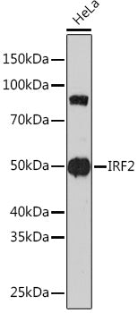 IRF2 Rabbit mAb