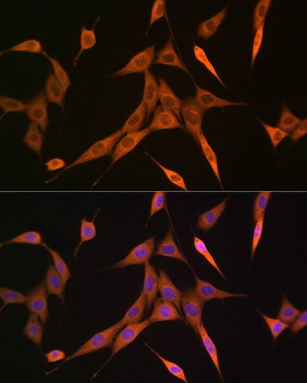 RHOA/RHOB/RHOC Rabbit mAb