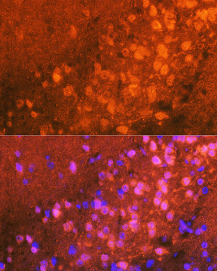 JNK1/2/3 Rabbit mAb