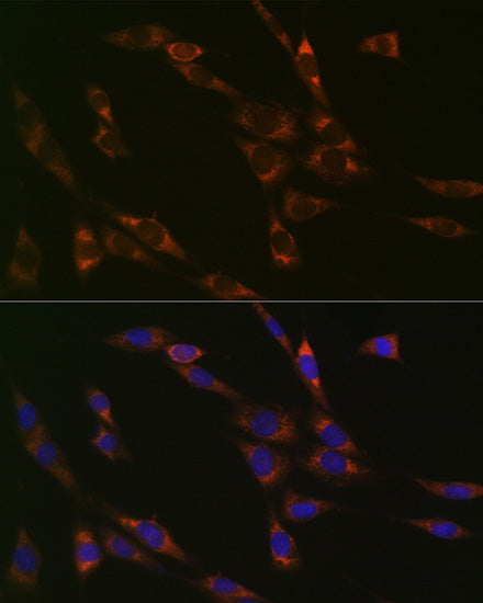 RPS3 Rabbit mAb
