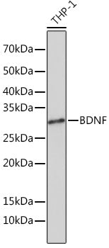 BDNF Rabbit mAb