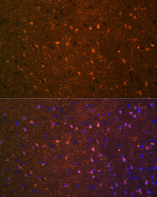 BDNF Rabbit mAb