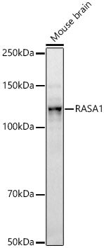 RASA1 Rabbit mAb