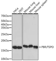 PBR/TSPO Rabbit mAb