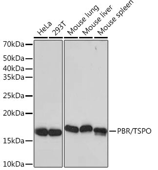 PBR/TSPO Rabbit mAb
