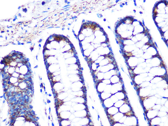 PBR/TSPO Rabbit mAb