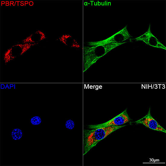 PBR/TSPO Rabbit mAb