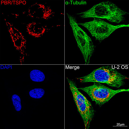 PBR/TSPO Rabbit mAb