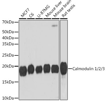 Calmodulin 1/2/3 Rabbit mAb