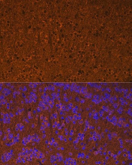 Calmodulin 1/2/3 Rabbit mAb
