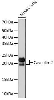 Caveolin-2  Rabbit mAb