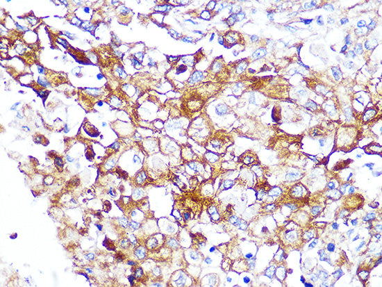 Caveolin-2  Rabbit mAb
