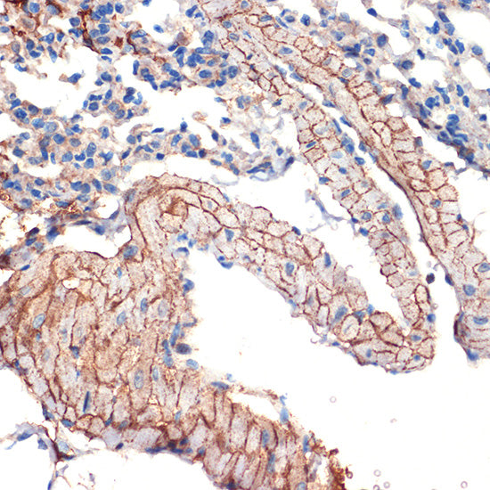 Caveolin-3  Rabbit mAb