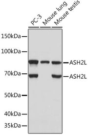 ASH2L Rabbit mAb