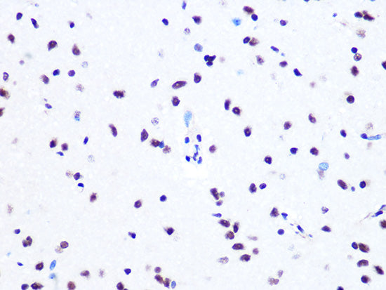 ASH2L Rabbit mAb