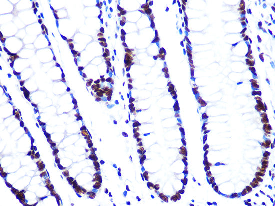 ASH2L Rabbit mAb