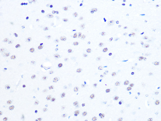 ASH2L Rabbit mAb