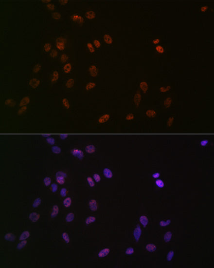 ASH2L Rabbit mAb