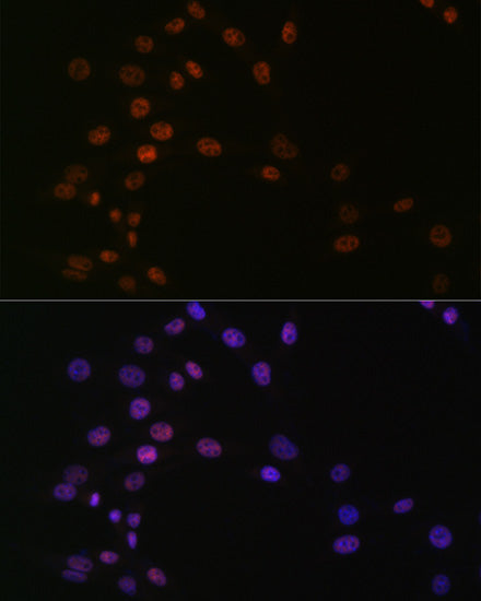 ASH2L Rabbit mAb