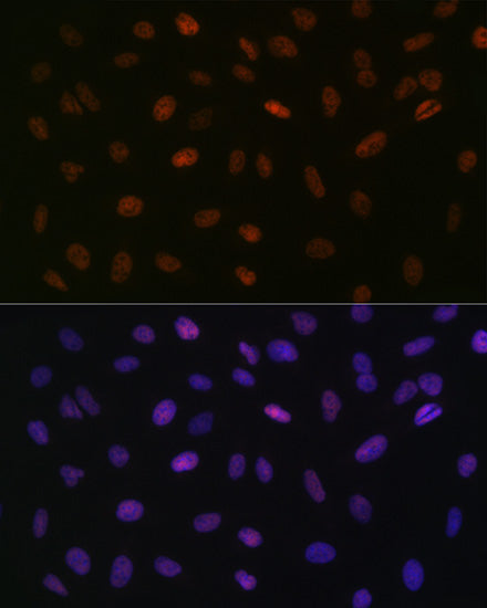 ASH2L Rabbit mAb