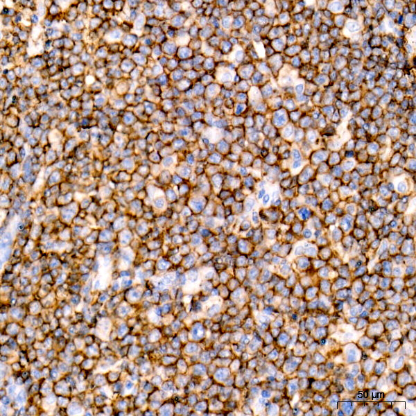 CD20 Rabbit mAb