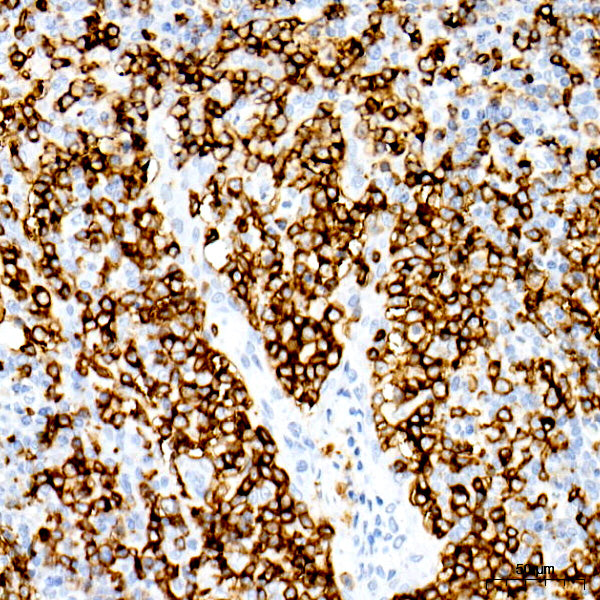 CD20 Rabbit mAb