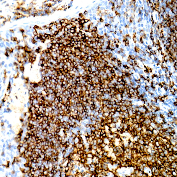 CD20 Rabbit mAb