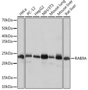RAB9A Rabbit mAb