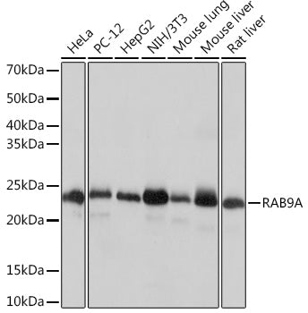 RAB9A Rabbit mAb
