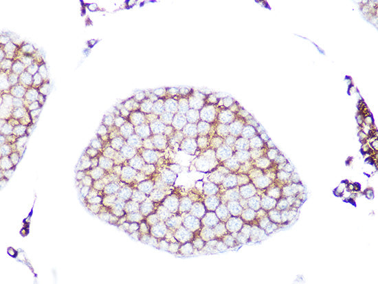 RAB9A Rabbit mAb