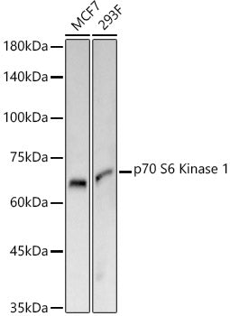 p70 S6 Kinase 1 Rabbit mAb