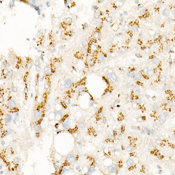 p70 S6 Kinase 1 Rabbit mAb