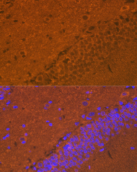 alpha + beta Synuclein Rabbit mAb