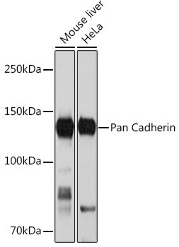 Pan Cadherin Rabbit mAb