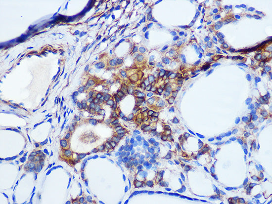 Pan Cadherin Rabbit mAb