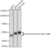 Creatine kinase B type (CKB) Rabbit mAb