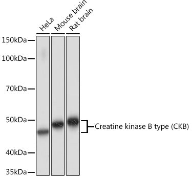 Creatine kinase B type (CKB) Rabbit mAb