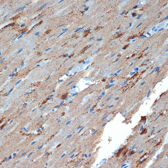 Creatine kinase B type (CKB) Rabbit mAb