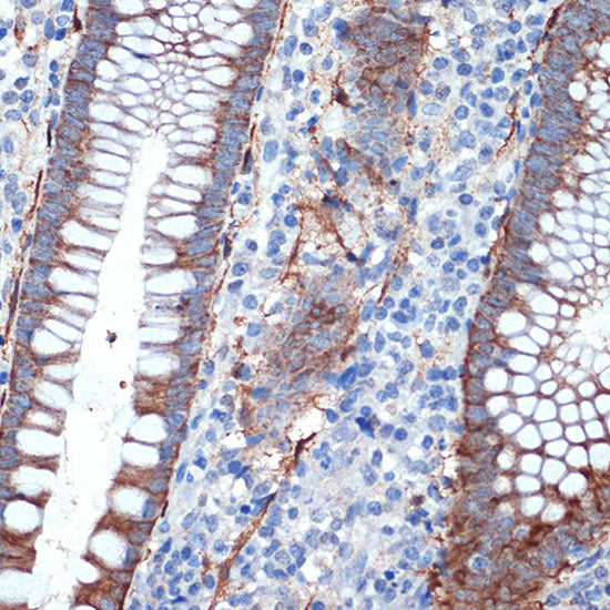 Creatine kinase B type (CKB) Rabbit mAb