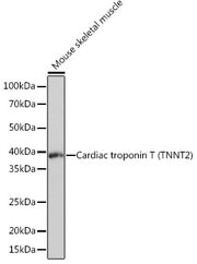 Cardiac troponin T (TNNT2) Rabbit mAb