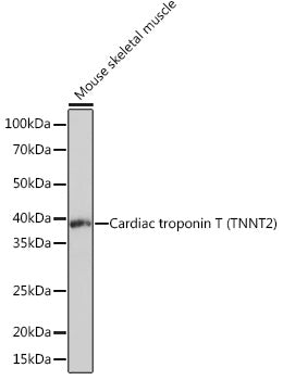 Cardiac troponin T (TNNT2) Rabbit mAb