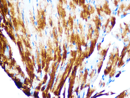 Cardiac troponin T (TNNT2) Rabbit mAb