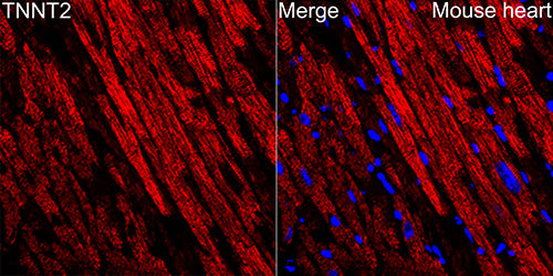 Cardiac troponin T (TNNT2) Rabbit mAb