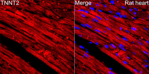 Cardiac troponin T (TNNT2) Rabbit mAb