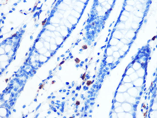 Moesin Rabbit mAb