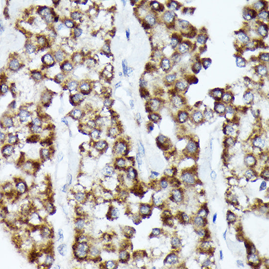 CDCA3 Rabbit mAb