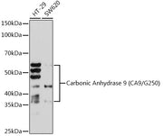 Carbonic Anhydrase 9 (CA9/G250) Rabbit mAb