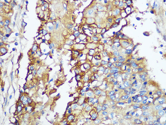 Carbonic Anhydrase 9 (CA9/G250) Rabbit mAb